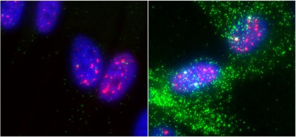Mysterious “nuclear speckle” structures inside cells enhance gene activity and may help block cancers: